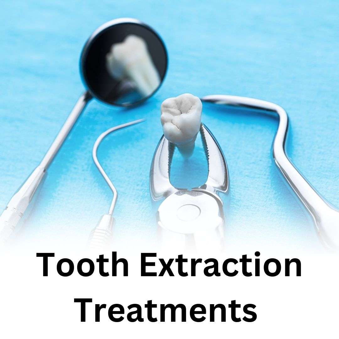 tooth-extr_1735452134GiD87M.jpeg