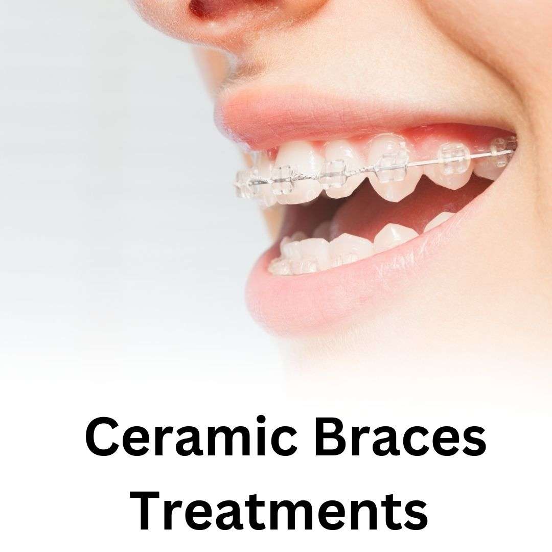 ceramic-br_1735481126iu0DSa.jpeg