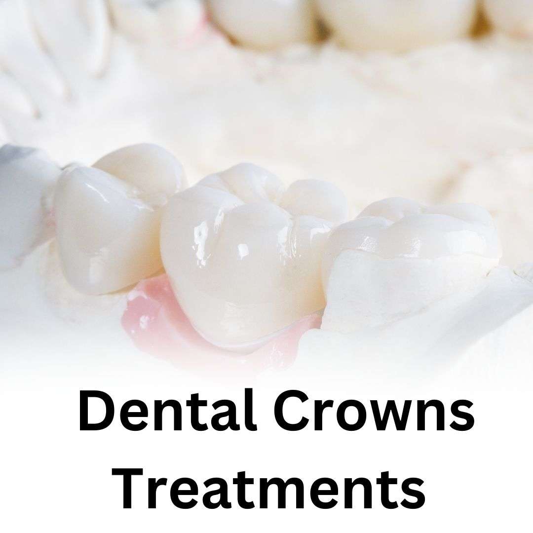 Dental Crowns