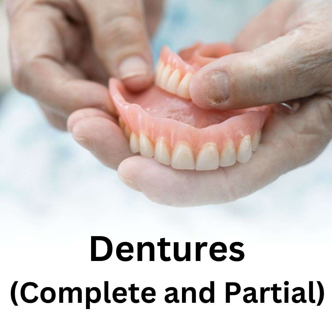 Dentures (Complete and Partial)