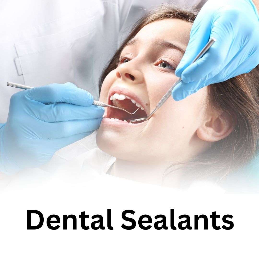 Dental Sealants