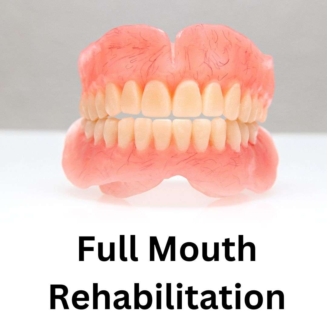 Full Mouth Rehabilitation